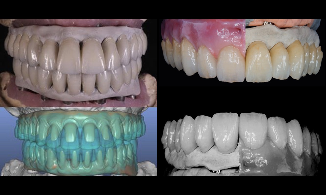 PEKTON-CAD-CAM