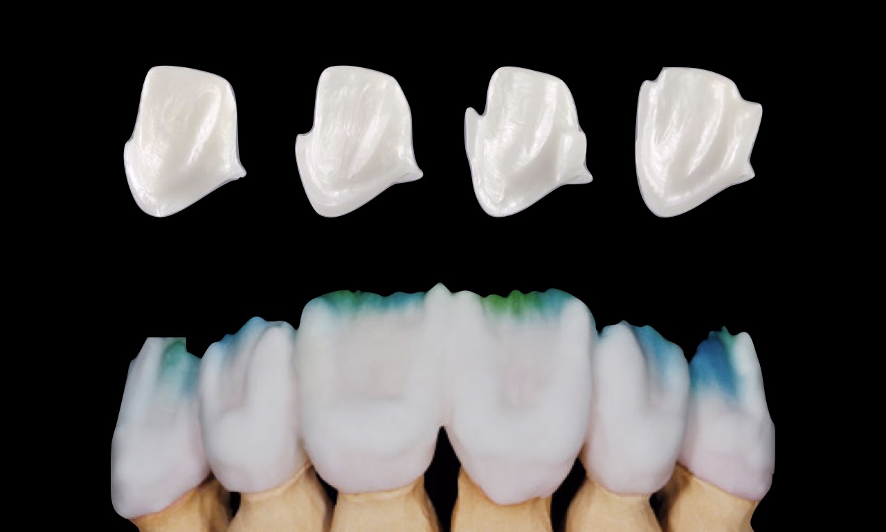 ceramizzazione-zirconia