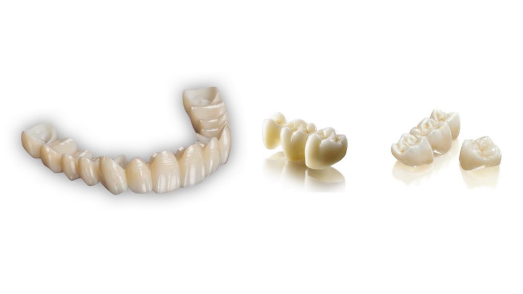 corone-zirconio-moldavia