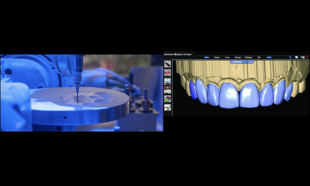 produzione-capsule
