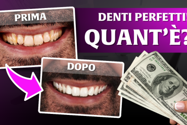 Sorriso perfetto, costi trasparenti: il Dr. Palmas sperimenta il Sistema Bocca Bionica su sé stesso per la sua riabilitazione dentale