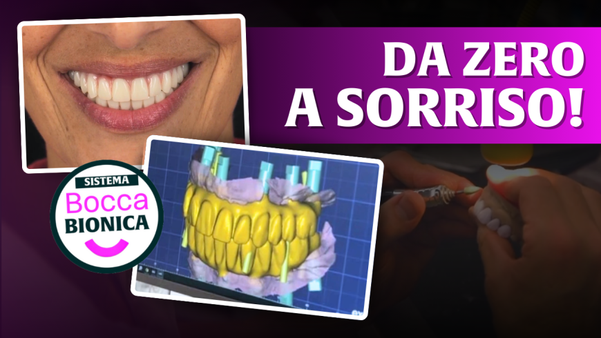 Backstage di un sorriso: il “dietro le quinte” delle riabilitazioni estreme della bocca