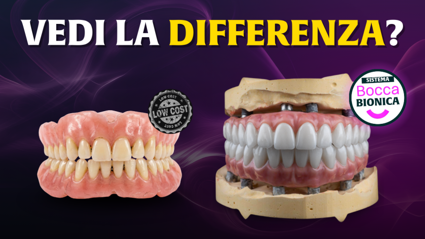 Riabilitazione estrema della bocca: come evitare l’effetto ‘denti finti’