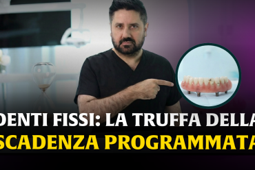 Denti fissi su impianti: attento a quelli con la ‘data di scadenza’. Tutta la verità sull’Odontoiatria ‘usa e getta’