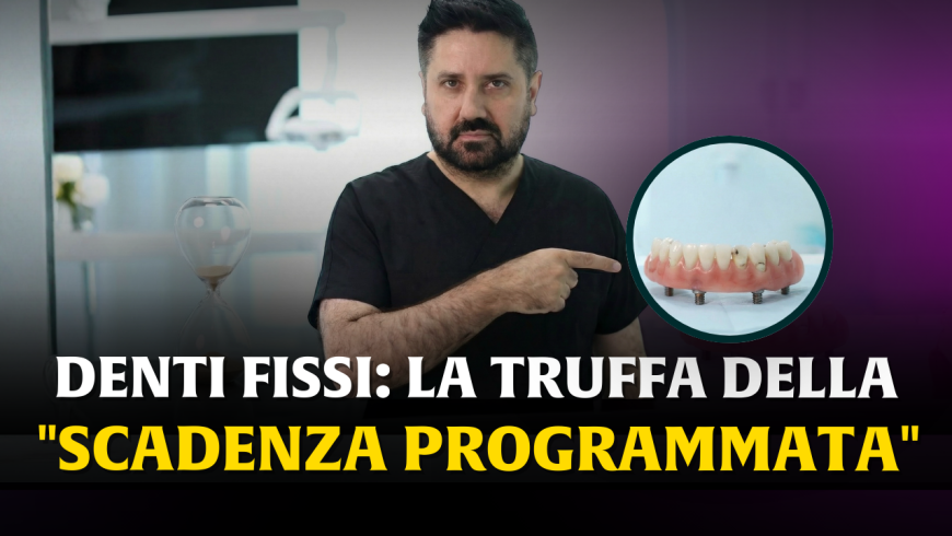 Denti fissi su impianti: attento a quelli con la ‘data di scadenza’. Tutta la verità sull’Odontoiatria ‘usa e getta’