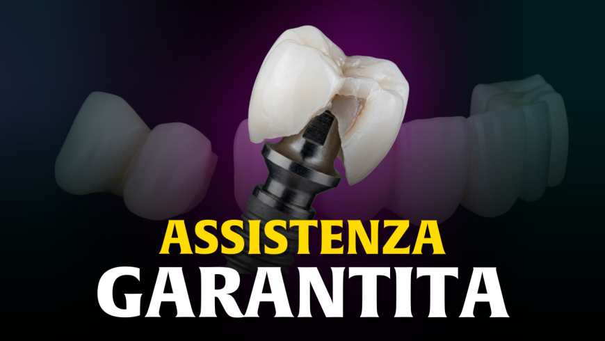 Riabilitazione estrema della bocca: ti curi in Moldavia, ti assistiamo nel tuo Paese