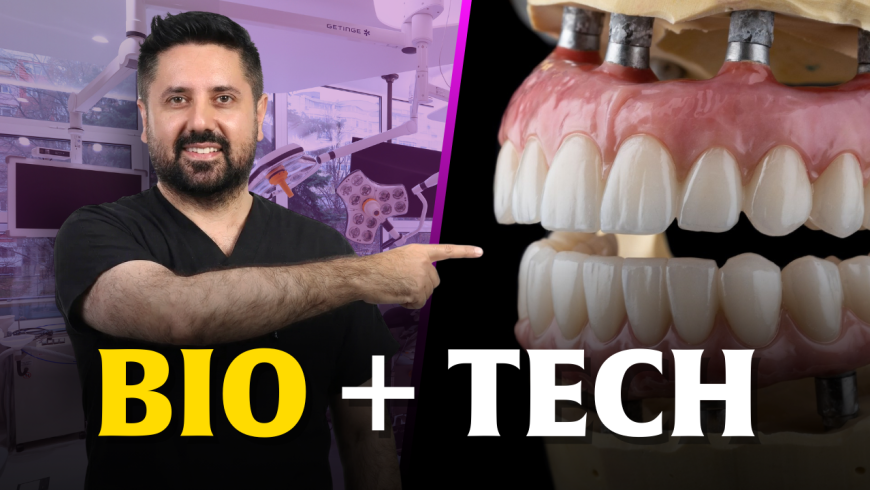 Sistema Bocca Bionica: non semplici denti fissi su impianti, ma una rivoluzione di bionica applicata